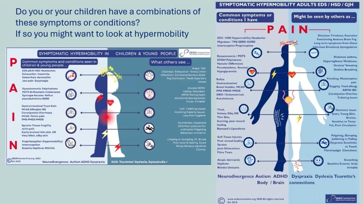 The Science of Hypermobility & ADHD — preview 2
