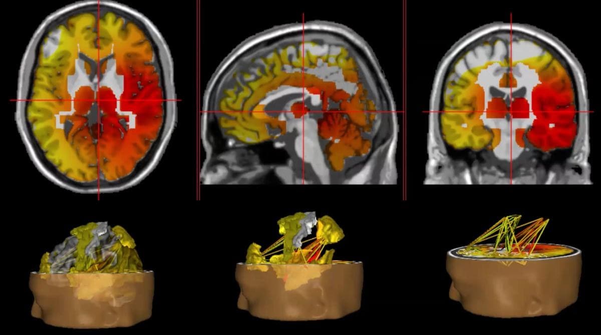 The Neuroscience of Irish Trauma — preview 4